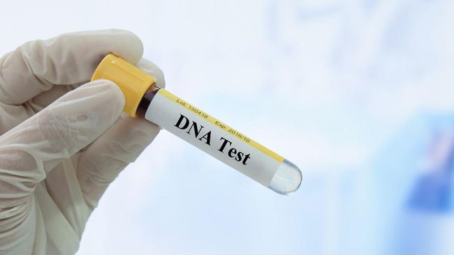 Jangan Ikut Tren Uji DNA Sebelum Tahu 5 Risiko Ini