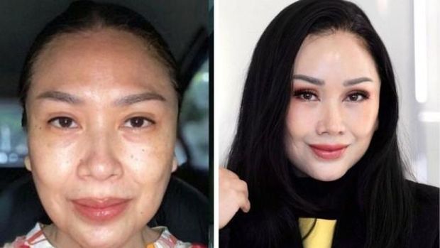 Pantesan Bikin Pangling, Ini 5 Operasi yang Dijalani Titi DJ