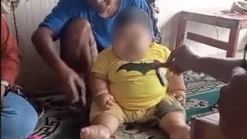 Viral Bayi Obesitas di Bekasi, Dokter Jelaskan Penyebabnya
