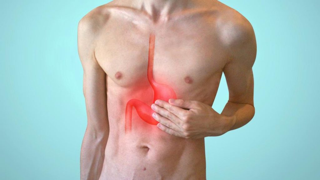 Dokter Beber Efek Penderita GERD Makan Seblak Coet Ala Rafae