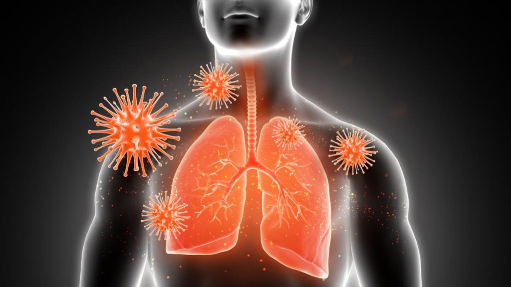 Sudah Ada Kasus Mycoplasma Pneumoniae di DKI, Ini Kata Dinkes