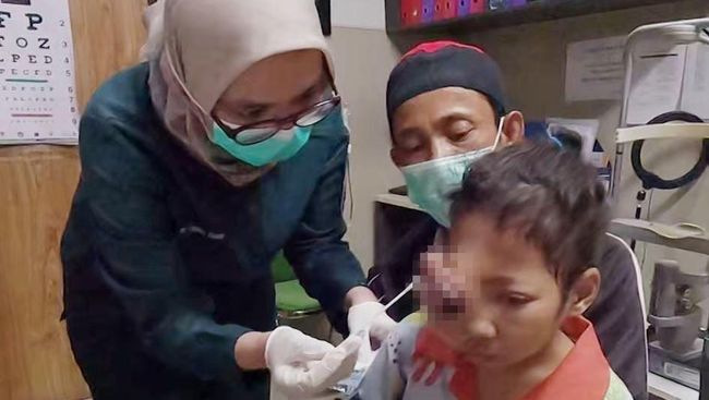 Nasib Anak Tukang Kebun, Semakin Kurus Idap Tumor-Kanker