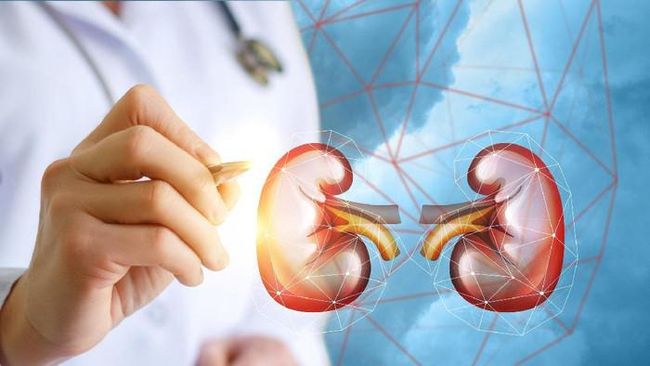 Lebih dari 700 Ribu Orang RI Menderita Ginjal Kronis
