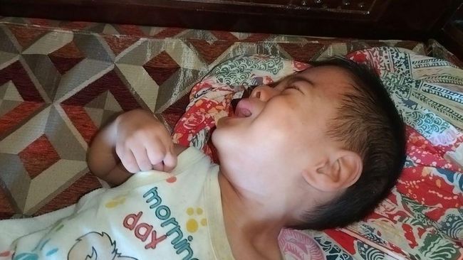 Kisah Pilu Bocah Yusril Berjuang Sembuh Tanpa Ayah Ibu