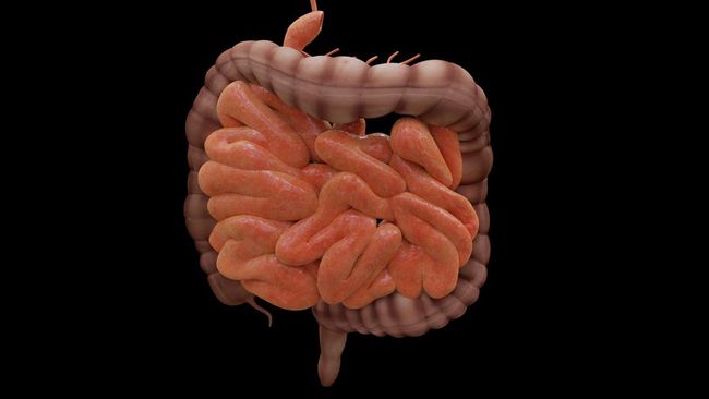 Waspada, Kebiasaan Sepele ini Bisa Tingkatkan Risiko Kanker Usus Lho