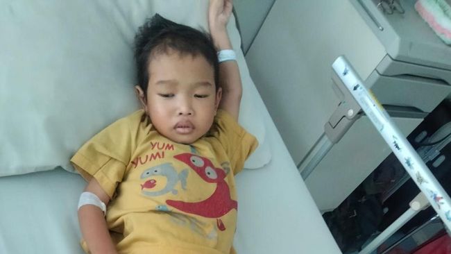 Jafar, Anak Sopir Penderita Kelainan Usus Langka tidak Bisa BAB Normal